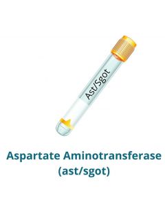 Aspartate Aminotransferase (ast/sgot)