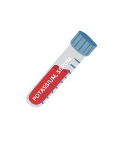 POTASSIUM, SERUM 